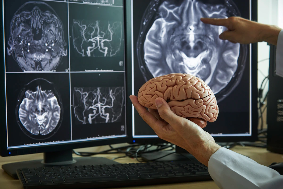brain model and MRI screen of brain shrinking from complaining